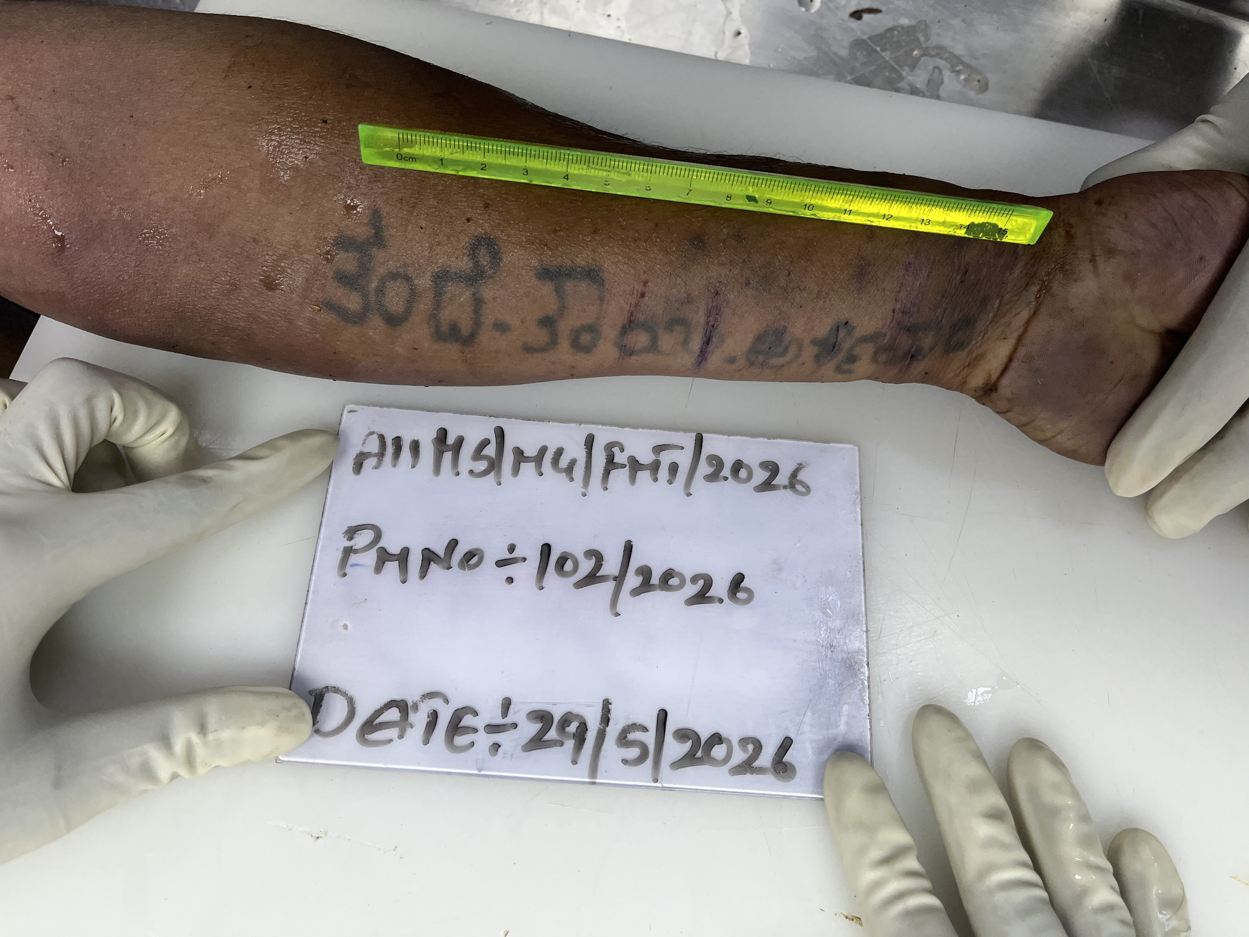Scar Image